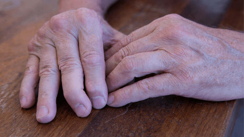 Condiciones autoinmunes